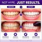 Before and after comparison of teeth whitening with text highlighting features.