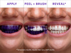 SMILE Purple Teeth Whitening Strips