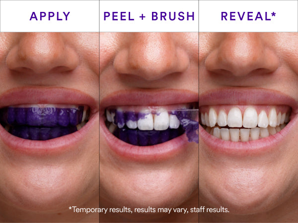 SMILE Purple Teeth Whitening Strips
