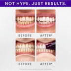 SMILE Purple Teeth Whitening Strips
